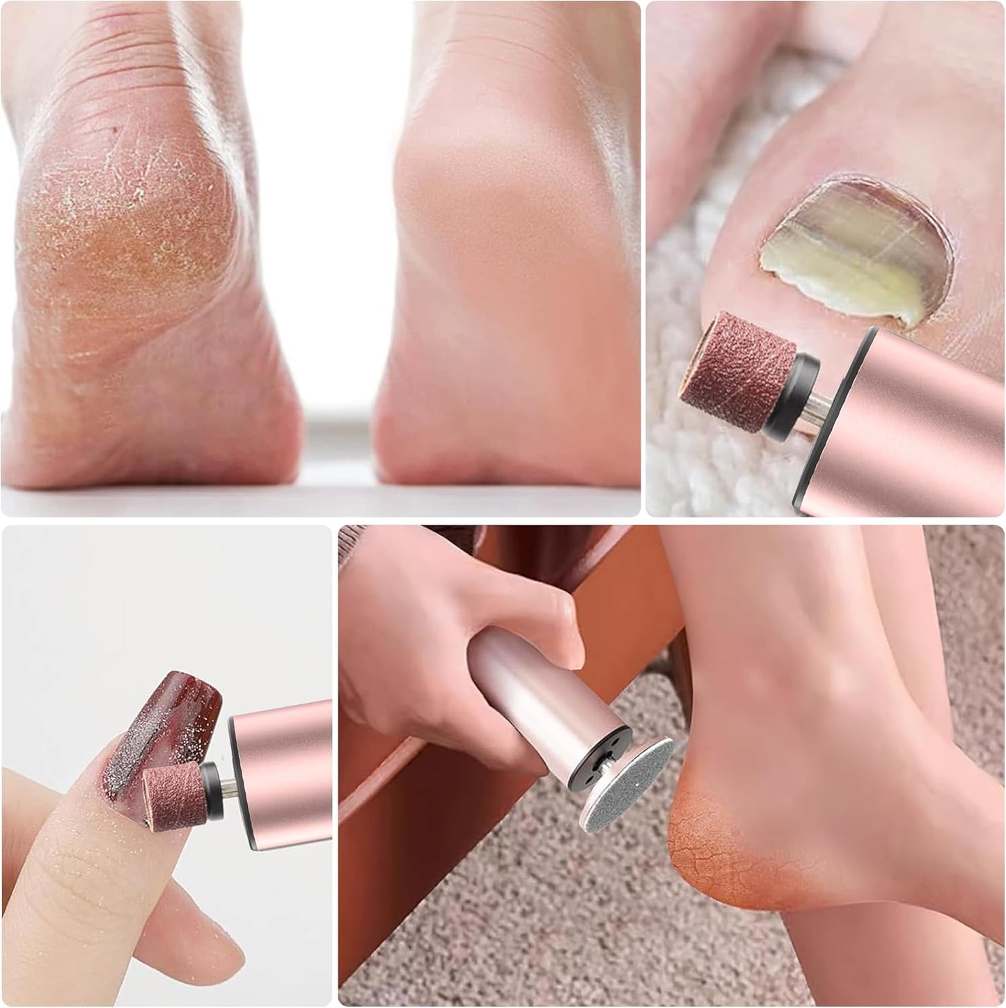 Pamrel™ Care Remover – Electric Foot Smoother